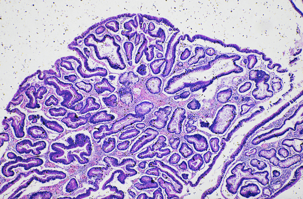 14 Surprising Things You Didn't Know About Your Gut Microbiome