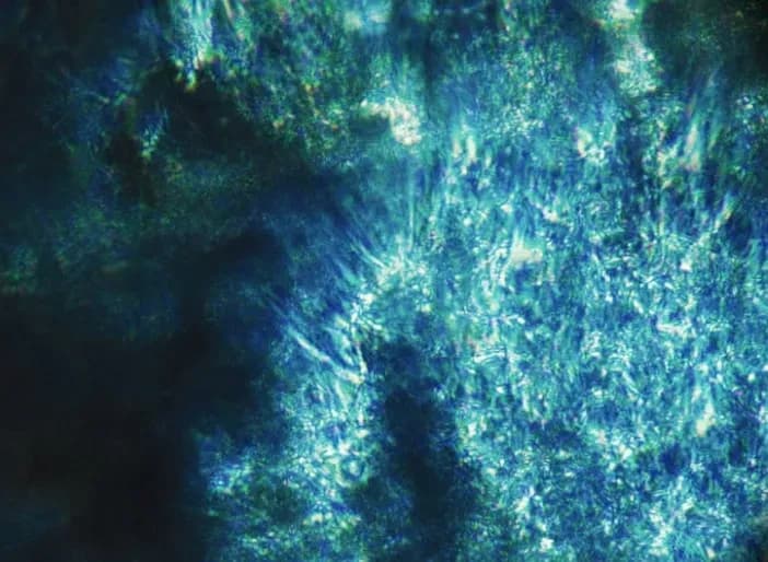 Oral and Throat Cancer Detection Test built on Viome platform, designated Breakthrough Device for accelerated Review by FDA